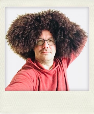 Avec une greffe de cheveux.JPG